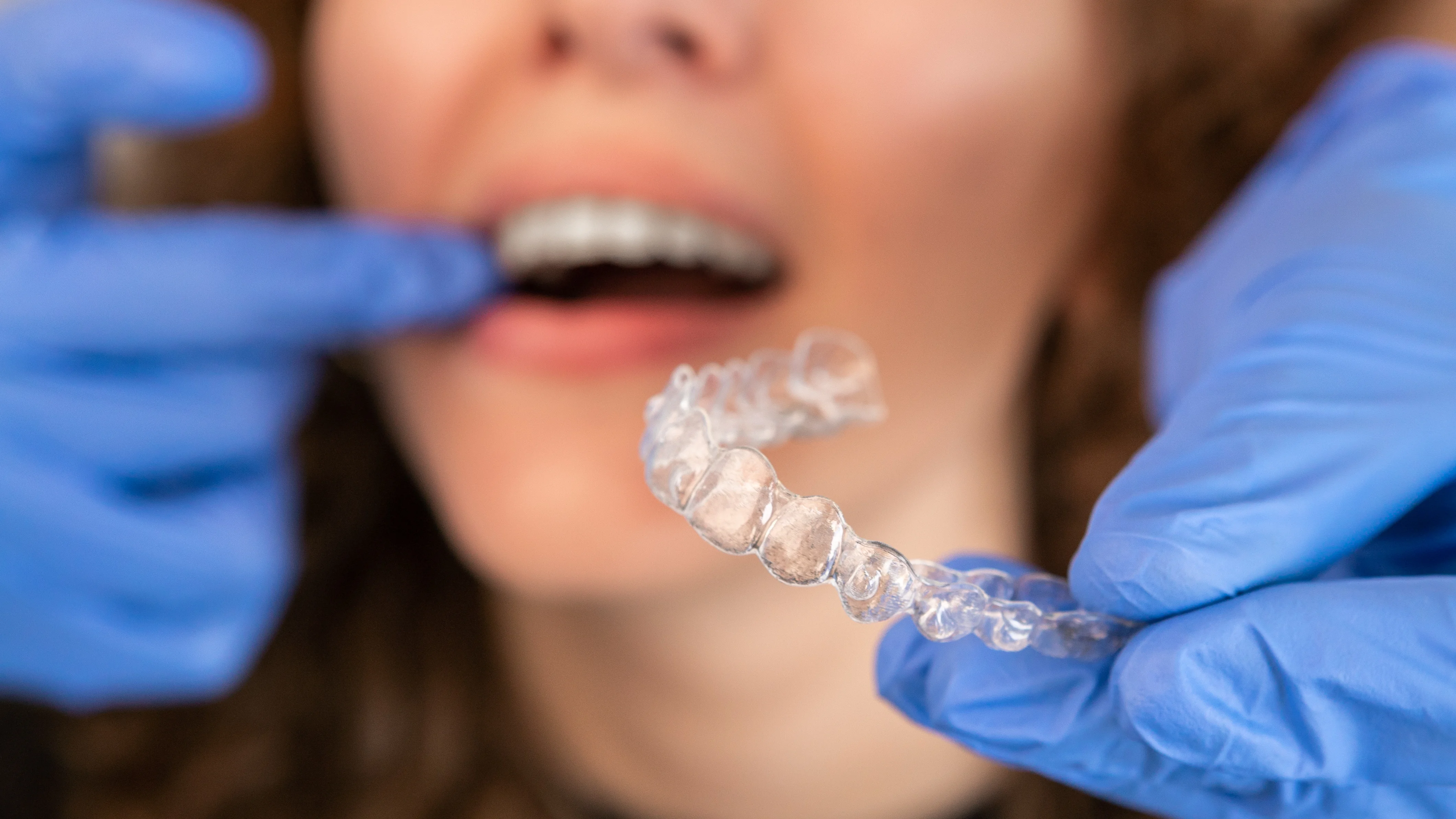Gentle Tooth Extractions at Eagle Lake Family Dental